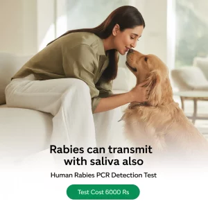 Rabies Detection RNA Qualitative PCR Test Humans Cost