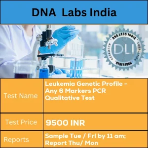 Leukemia Genetic Profile - Any 6 Markers PCR Qualitative Test cost 3 mL (2 mL min.) whole blood / Bone Marrow Aspirate in 1 Lavender Top (EDTA) tube. Ship refrigerated. DO NOT FREEZE. Specify the 6 markers selected on Test Request Form. Give brief clinical history. INR in India