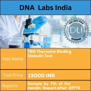 TBG Thyroxine Binding Globulin Test cost 2 mL (1 mL min.) serum from 1 SST. Ship  refrigerated  or  frozen. Duly filled Test Send Out Consent Form (Form 35) is mandatory. INR in India