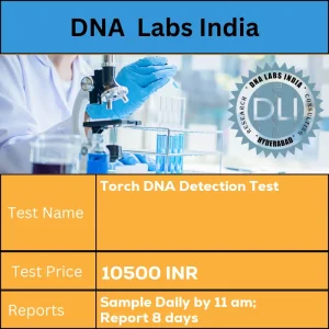 Torch DNA Detection Test cost 4 mL (2 mL min.) plasma from 1 Lavender top (EDTA) tube OR 3 mL (2 mL min.) CSF/ Amniotic fluid in a sterile screw capped container. Ship refrigerated. DO NOT FREEZE. INR in India