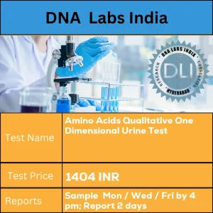 Amino Acids Qualitative One Dimensional Urine Test cost 5 mL (2 mL min.) aliquot of first morning urine in a sterile screw capped container. No preservative required. Ship refrigerated or frozen. Clinical details and drug history must accompany sample. INR in India