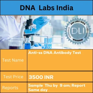 Anti-ss DNA Antibody Test cost 2 mL (1 mL min.) serum from 1 SST.nShip refrigerated or frozen. INR in India