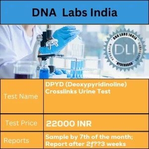 DPYD (Deoxypyridinoline) Crosslinks Urine Test cost 20 mL (10 mL min.) aliquot of random urine  in a sterile screw capped container. Ship refrigerated or frozen. Duly filled Test Send Out Consent Form (Form 35) is mandatory. INR in India
