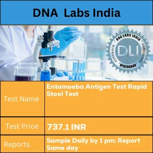 Entamoeba Antigen Test Rapid Stool Test cost 5 g (3 g min.) fresh stool in a sterile screw capped container. Ship refrigerated. DO NOT FREEZE. INR in India