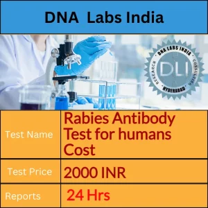 Rabies Antibody Test for humans cost 2000 INR at DNA Labs India