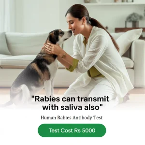 Rabies Antibody Test