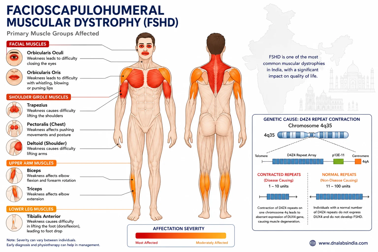 Understanding Facioscapulohumeral Muscular Dystrophy (FSHD): A Guide for the Indian Population