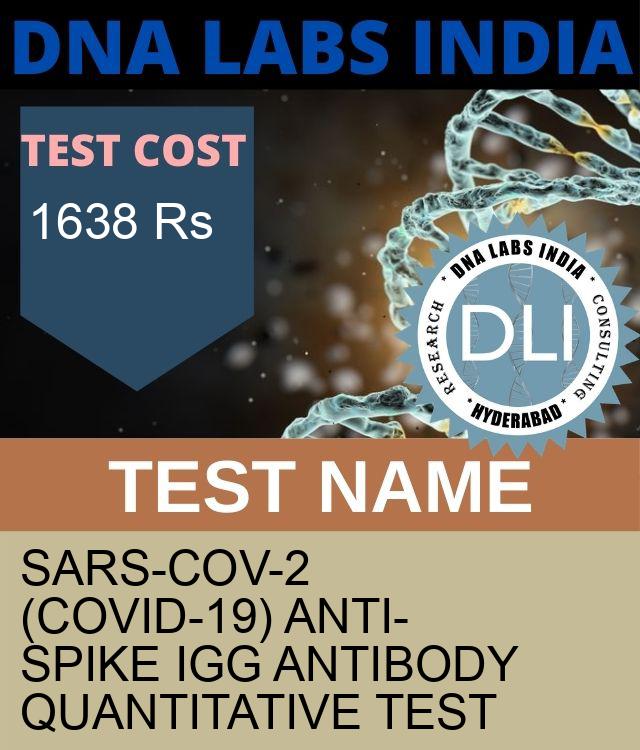 SARS-CoV-2 ANTI-SPIKE IgG ANTIBODY QUANTITATIVE Test