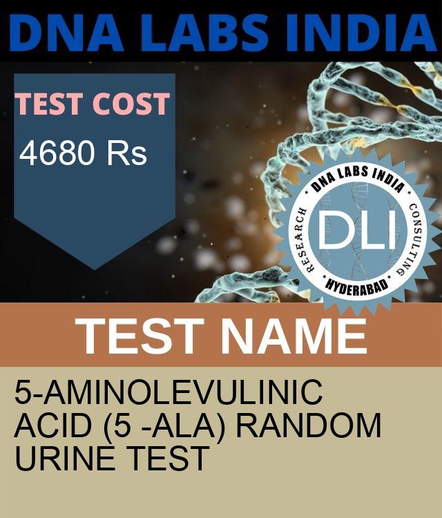 5-AMINOLEVULINIC ACID (5 -ALA) RANDOM URINE Test