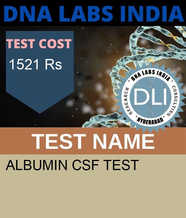 ALBUMIN CSF Test