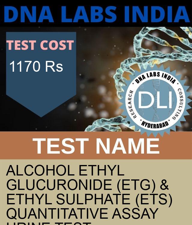 ALCOHOL ETHYL GLUCURONIDE (EtG) & ETHYL SULPHATE (EtS) QUANTITATIVE ASSAY URINE Test