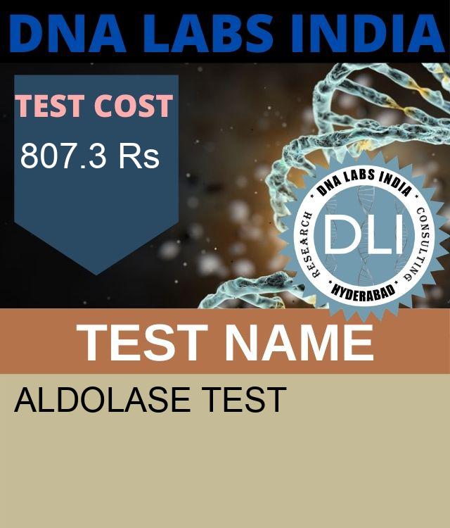 ALDOLASE Test