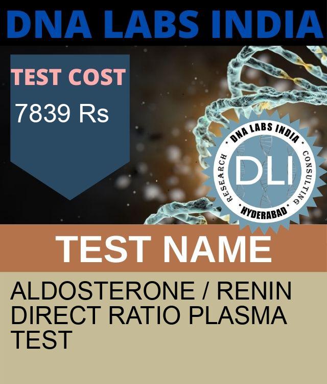 ALDOSTERONE / RENIN DIRECT RATIO PLASMA Test