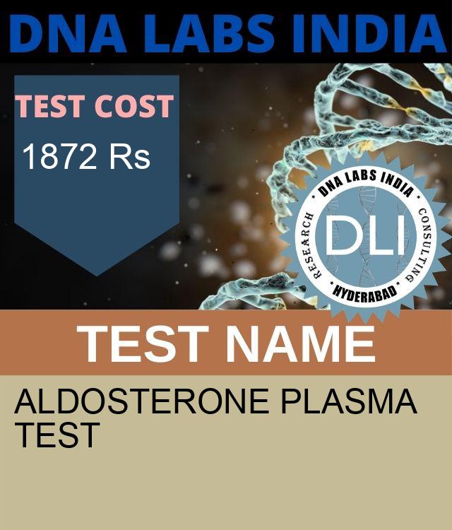 ALDOSTERONE PLASMA Test