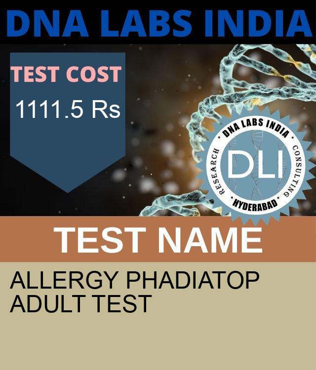 ALLERGY PHADIATOP ADULT Test
