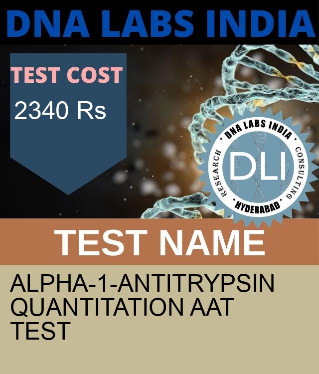 ALPHA-1-ANTITRYPSIN QUANTITATION AAT Test