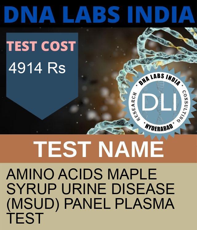 AMINO ACIDS MAPLE SYRUP URINE DISEASE (MSUD) PANEL PLASMA Test