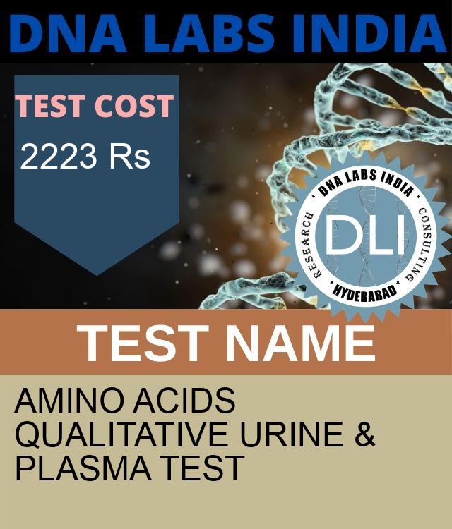 AMINO ACIDS QUALITATIVE URINE & PLASMA Test
