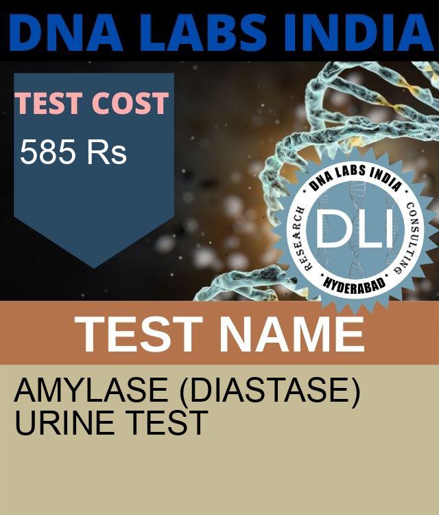 AMYLASE (DIASTASE) URINE Test