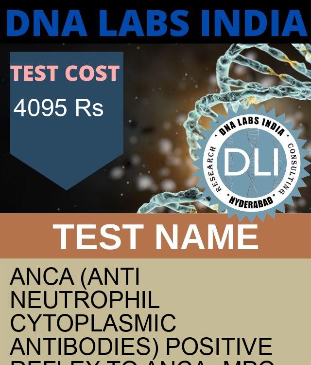 ANCA (ANTI NEUTROPHIL CYTOPLASMIC ANTIBODIES) POSITIVE REFLEX TO ANCA- MPO & ANCA-PR3 Test