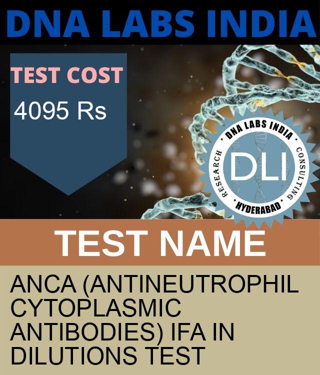 ANCA (ANTINEUTROPHIL CYTOPLASMIC ANTIBODIES) IFA IN DILUTIONS Test