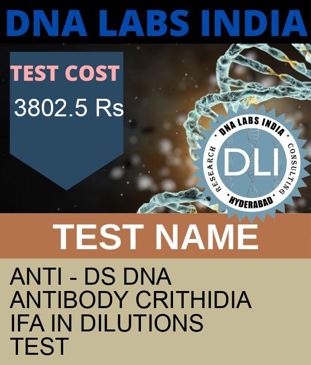 ANTI - ds DNA ANTIBODY CRITHIDIA IFA IN DILUTIONS Test