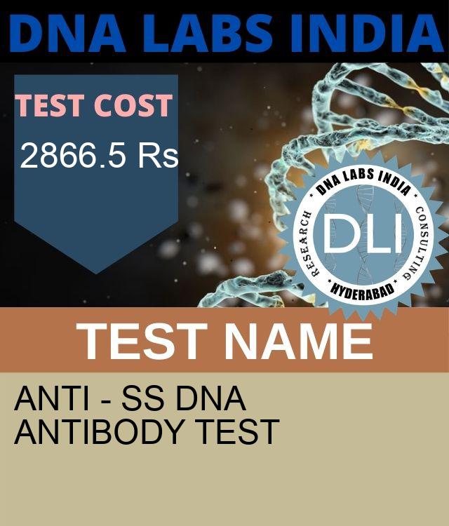 ANTI - ss DNA ANTIBODY Test