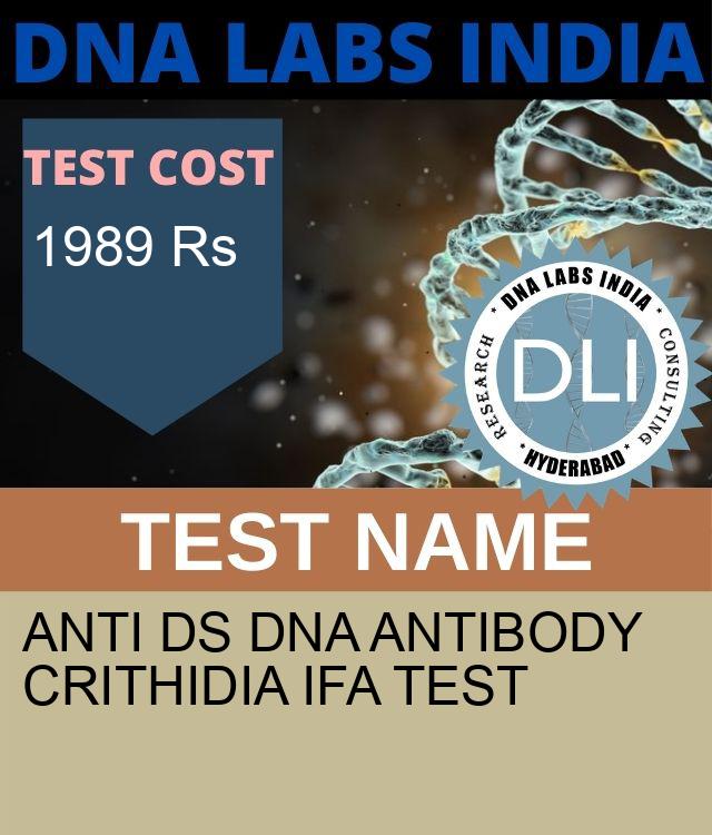 ANTI ds DNA ANTIBODY CRITHIDIA IFA Test