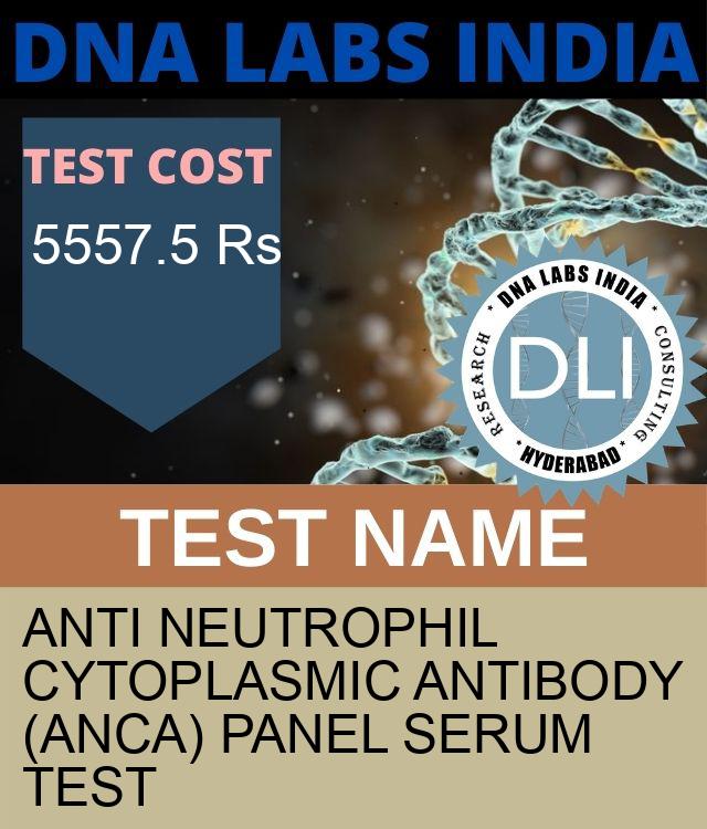 ANTI NEUTROPHIL CYTOPLASMIC ANTIBODY (ANCA) PANEL SERUM Test