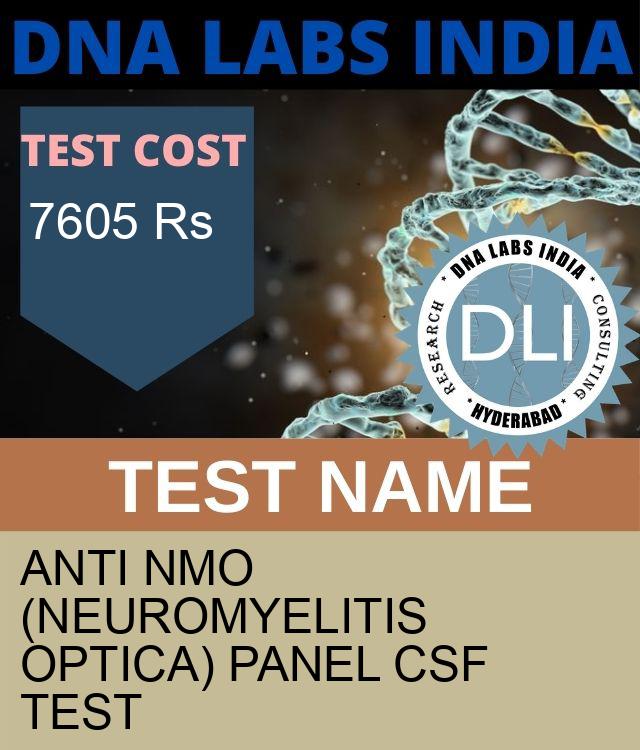 ANTI NMO (NEUROMYELITIS OPTICA) PANEL CSF Test