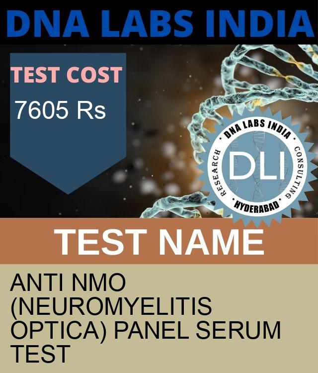 ANTI NMO (NEUROMYELITIS OPTICA) PANEL SERUM Test
