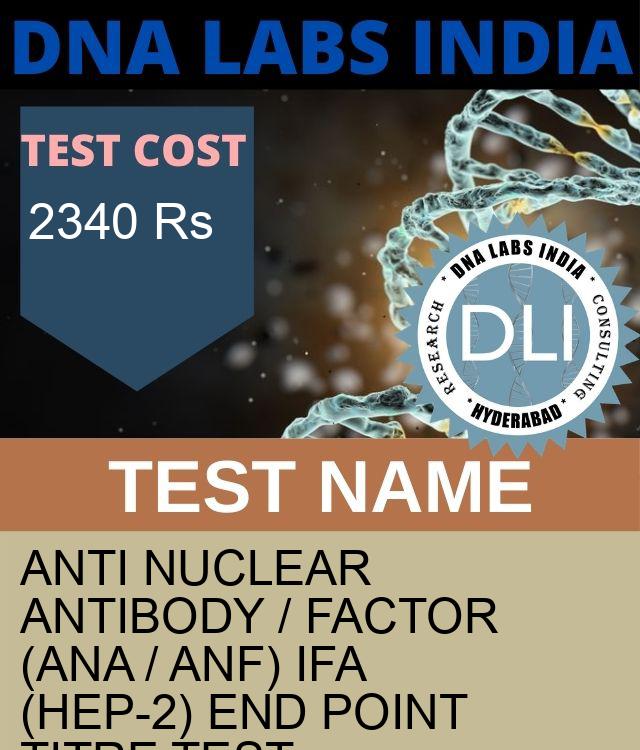 ANTI NUCLEAR ANTIBODY / FACTOR (ANA / ANF) IFA (HEP-2) END POINT TITRE Test