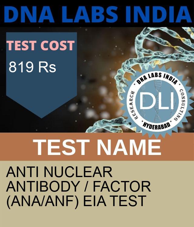 ANTI NUCLEAR ANTIBODY / FACTOR (ANA/ANF) EIA Test