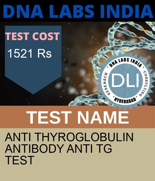 ANTI THYROGLOBULIN ANTIBODY ANTI Tg Test