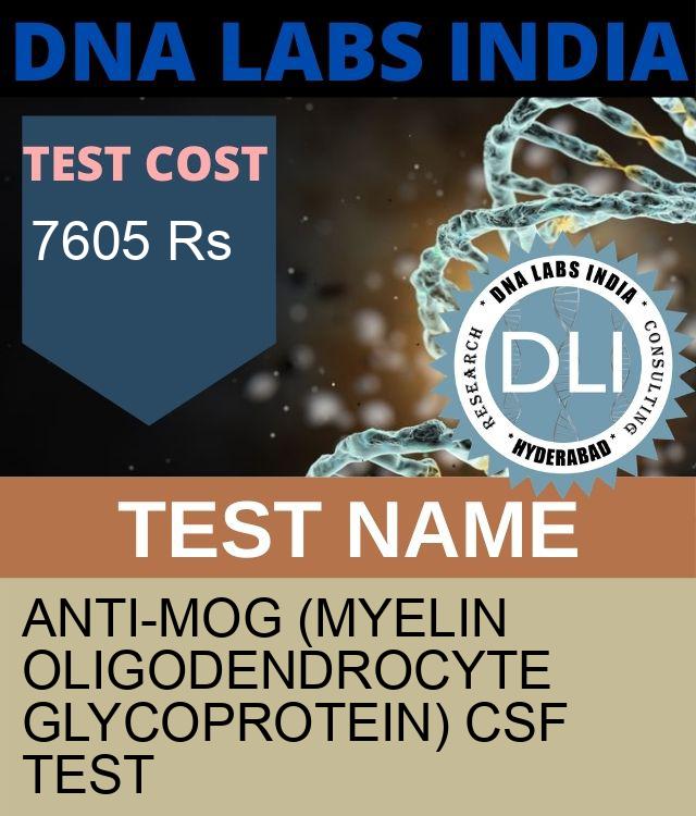 ANTI-MOG (MYELIN OLIGODENDROCYTE GLYCOPROTEIN) CSF Test