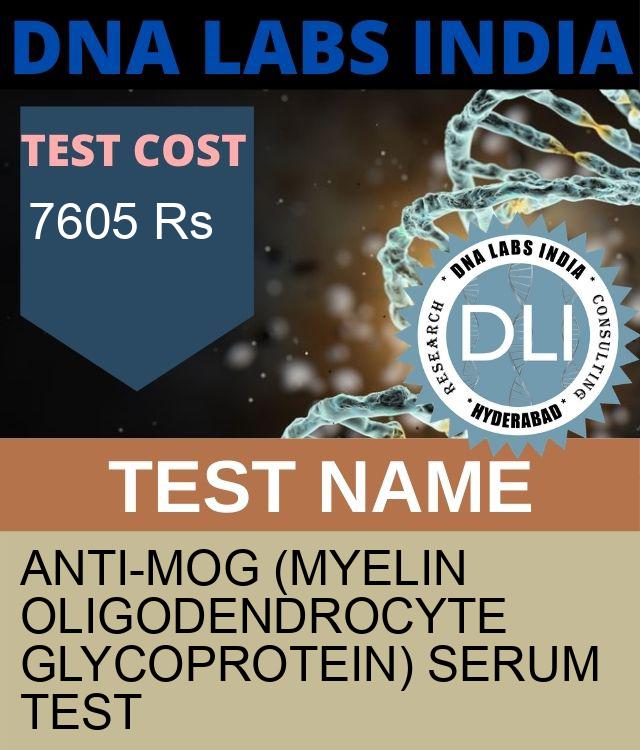 ANTI-MOG (MYELIN OLIGODENDROCYTE GLYCOPROTEIN) SERUM Test