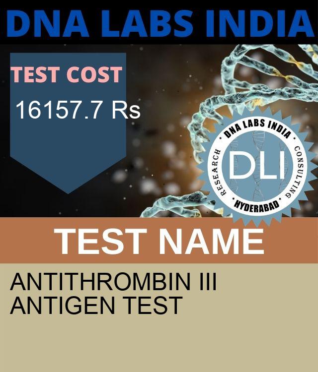ANTITHROMBIN III ANTIGEN Test