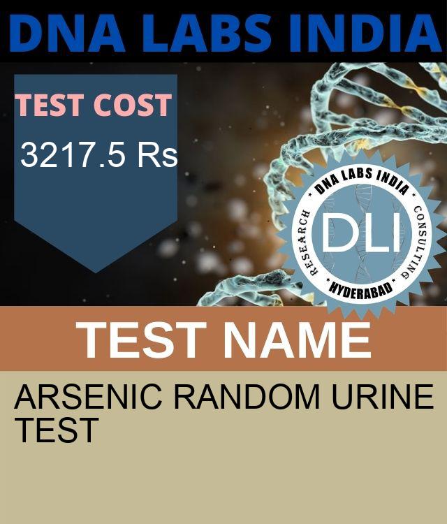 ARSENIC RANDOM URINE Test