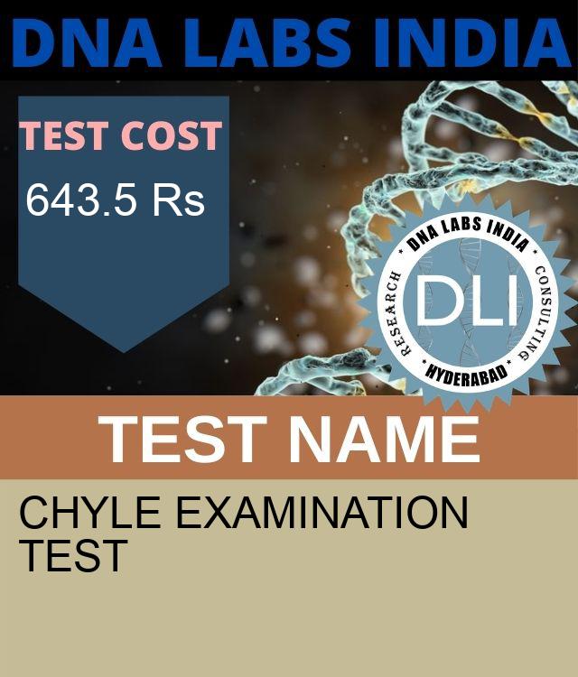 CHYLE EXAMINATION Test