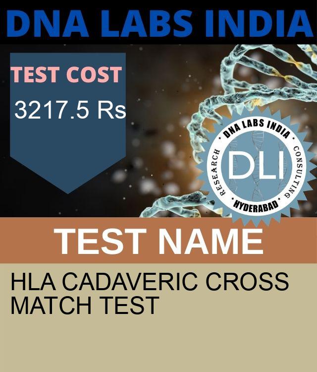HLA CADAVERIC CROSSMATCH Test