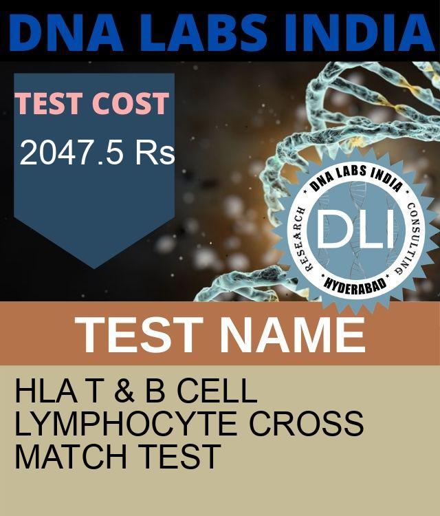 HLA T & B CELL LYMPHOCYTE CROSSMATCH Test