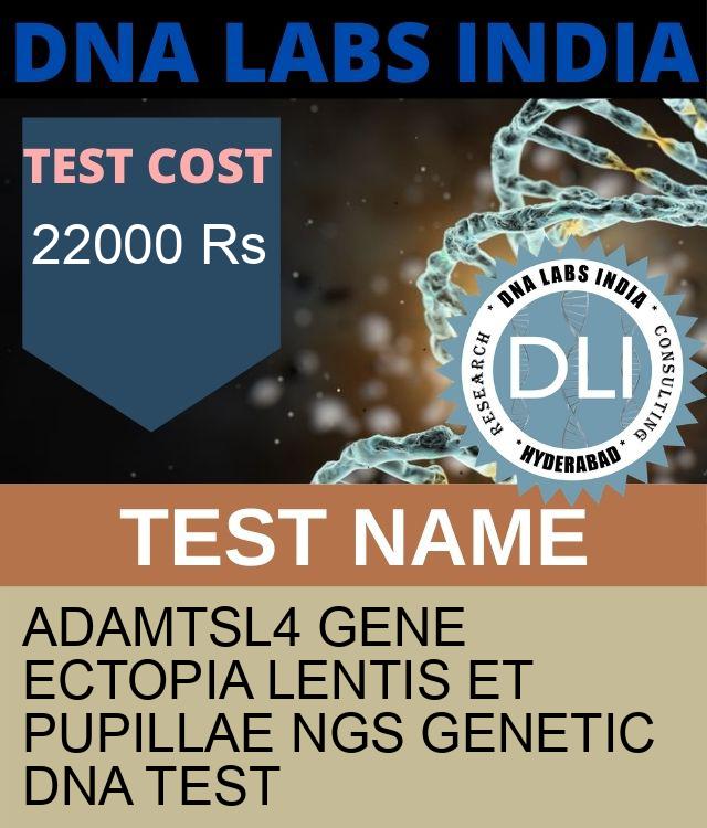 ADAMTSL4 Gene Ectopia lentis et pupillae NGS Genetic DNA Test