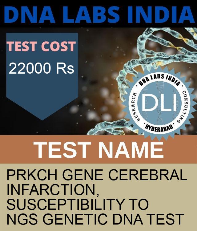 PRKCH Gene Cerebral infarction, susceptibility to NGS Genetic DNA Test