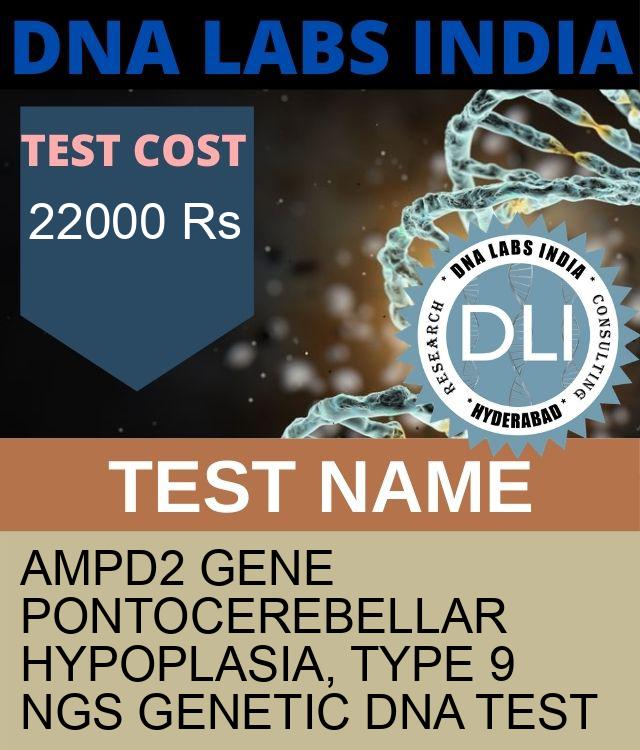 AMPD2 Gene Pontocerebellar hypoplasia, type 9 NGS Genetic DNA Test