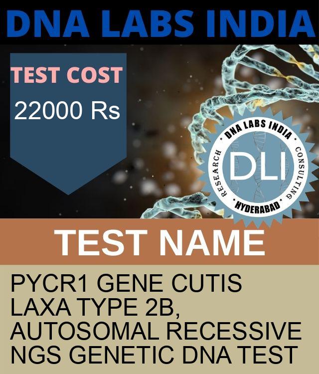PYCR1 Gene Cutis laxa type 2B, autosomal recessive NGS Genetic DNA Test