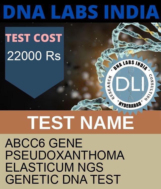 ABCC6 Gene Pseudoxanthoma elasticum NGS Genetic DNA Test