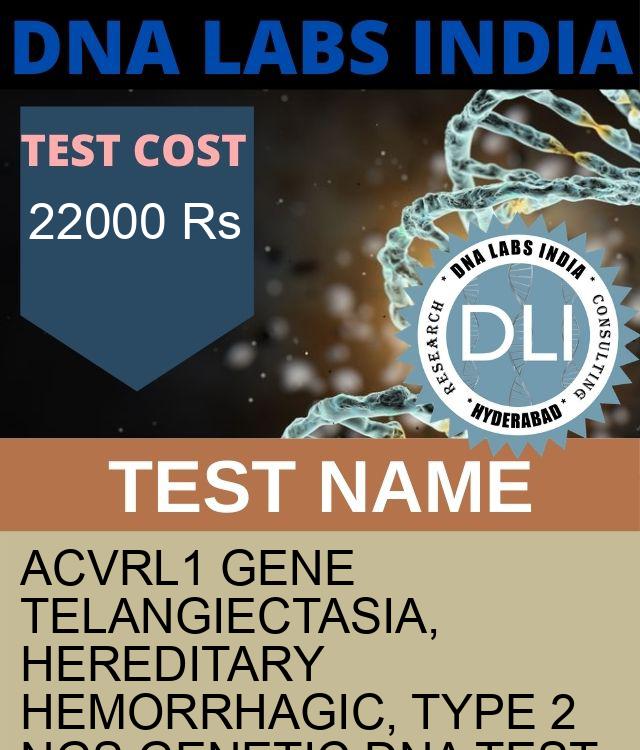 ACVRL1 Gene Telangiectasia, hereditary hemorrhagic, type 2 NGS Genetic DNA Test