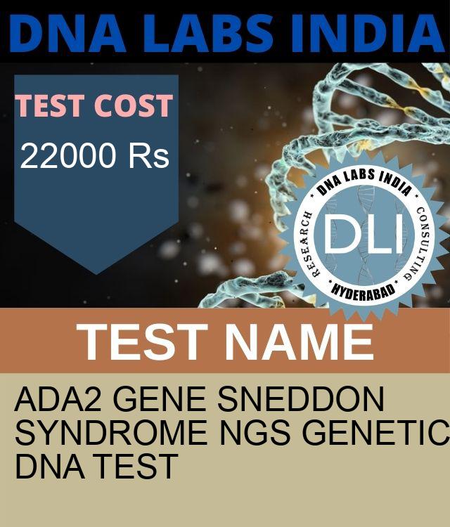 ADA2 Gene Sneddon syndrome NGS Genetic DNA Test