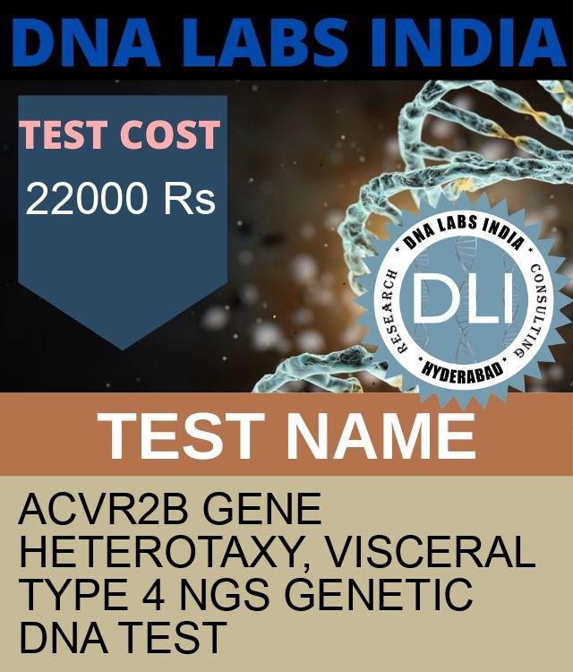 ACVR2B Gene Heterotaxy, visceral type 4 NGS Genetic DNA Test