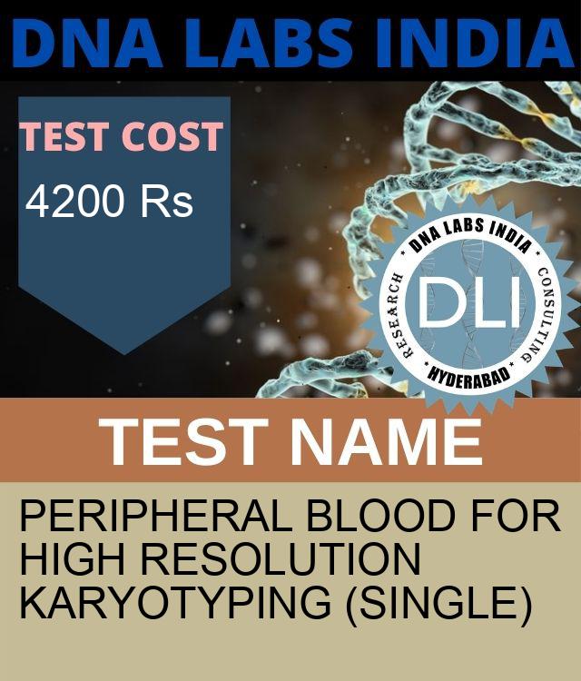 Peripheral blood for High resolution Single Karyotyping